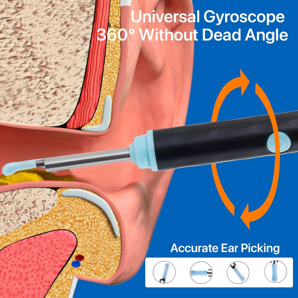 Smart Wireless Ear Cleaning Camera