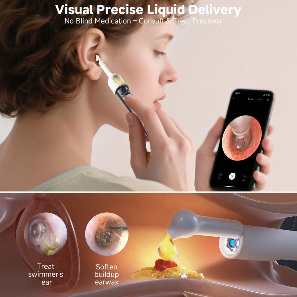 Smart Wireless Ear Cleaning Camera